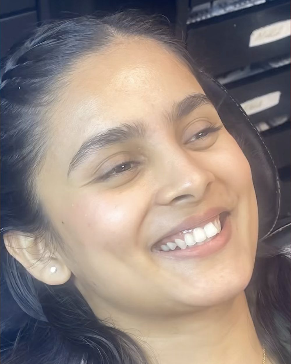 Brighter, smoother skin after a facial